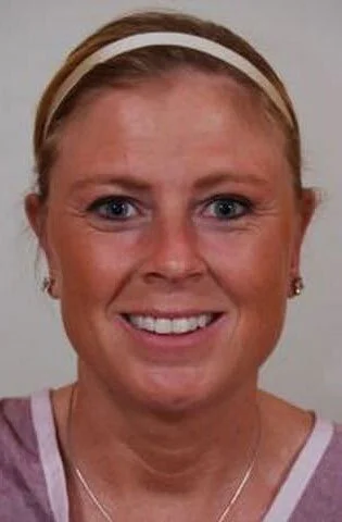 Otoplasty — After