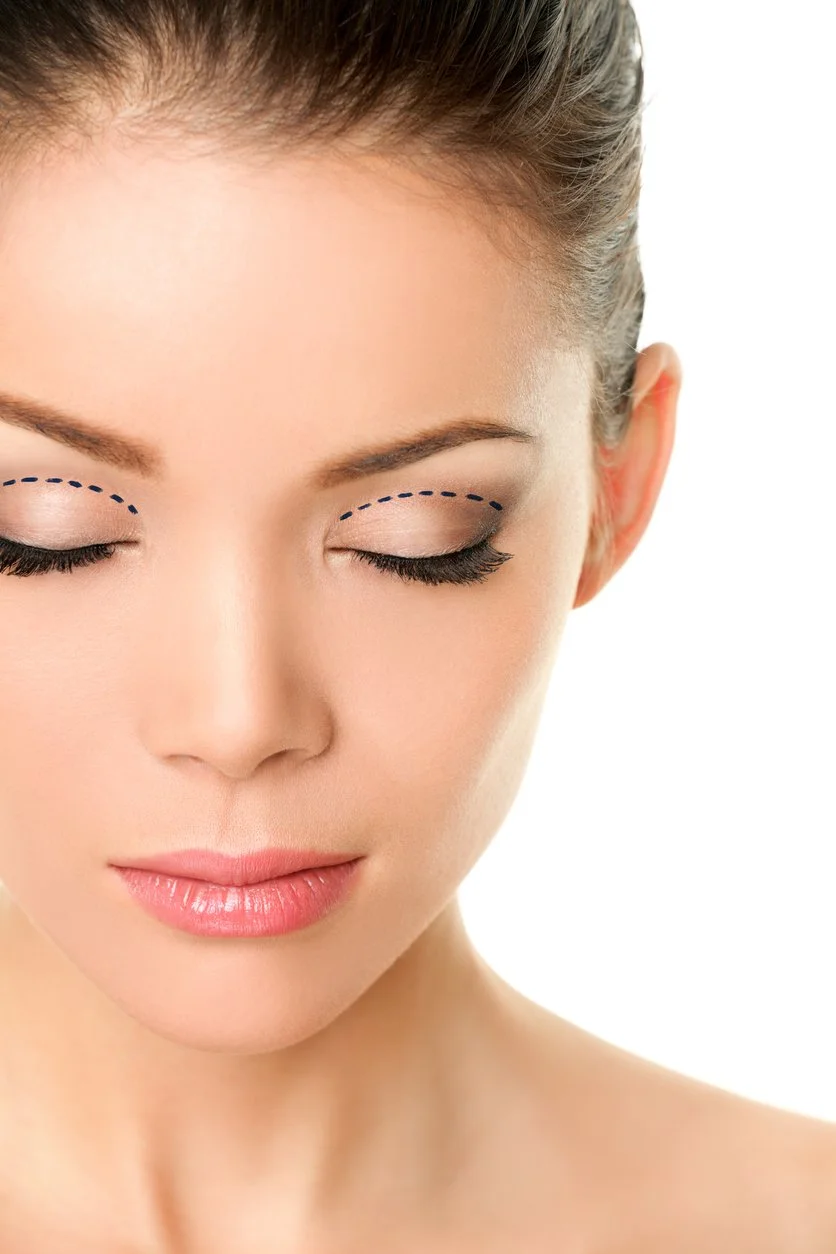 Blepharoplasty