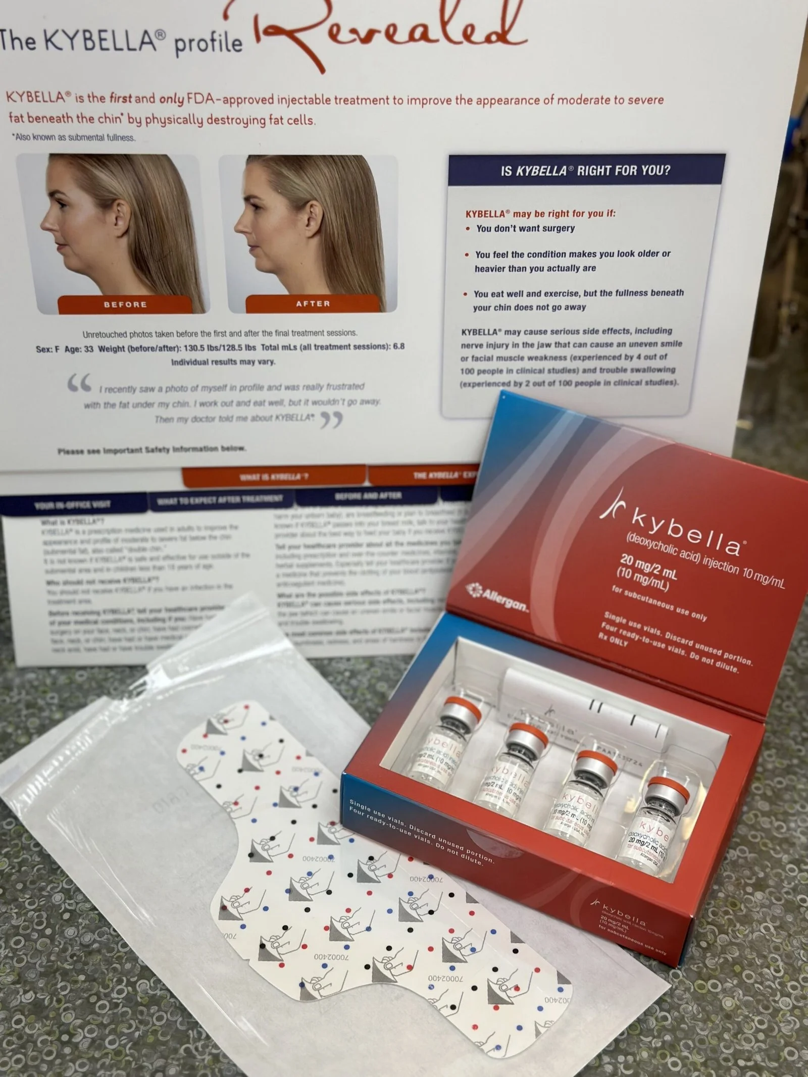 Kybella