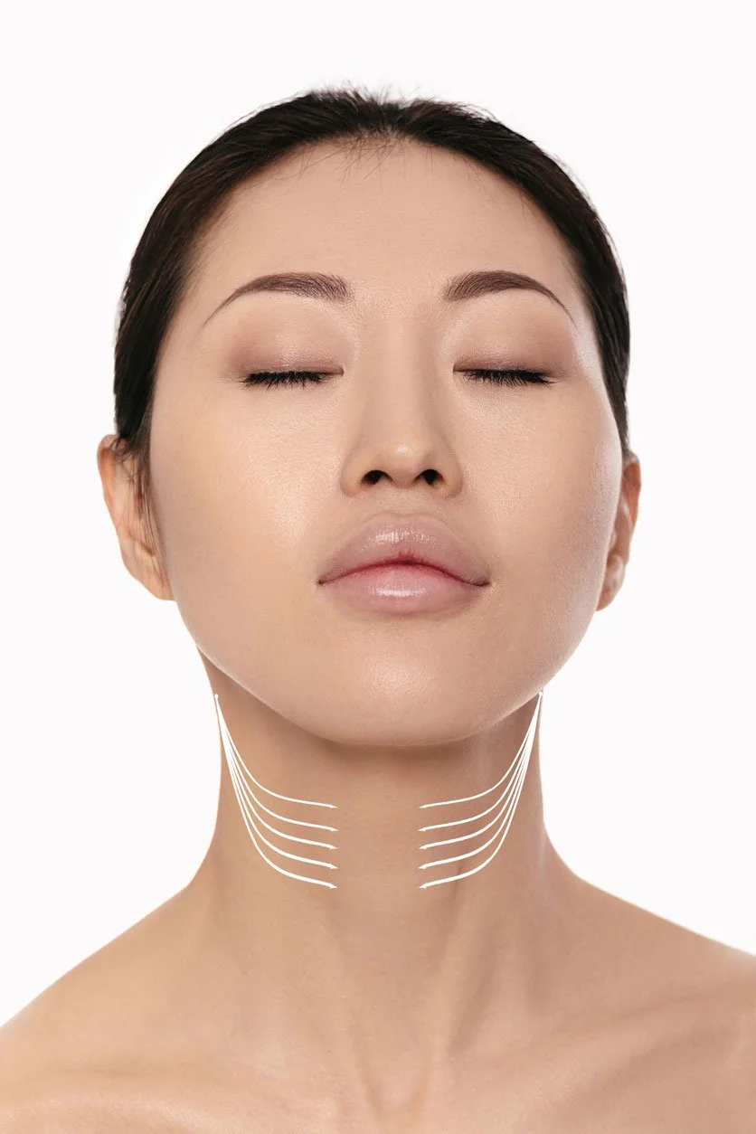 Neck Lift